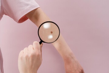 Melanoma