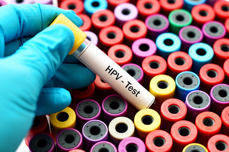 Test dell'Hpv. Attestazione: jarun011 - iStock