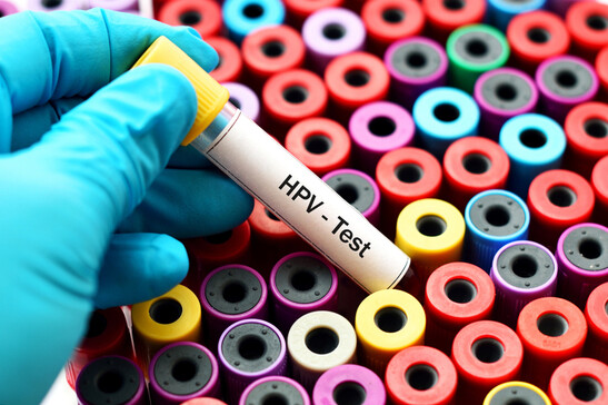 Test dell'Hpv. Attestazione: jarun011 - iStock