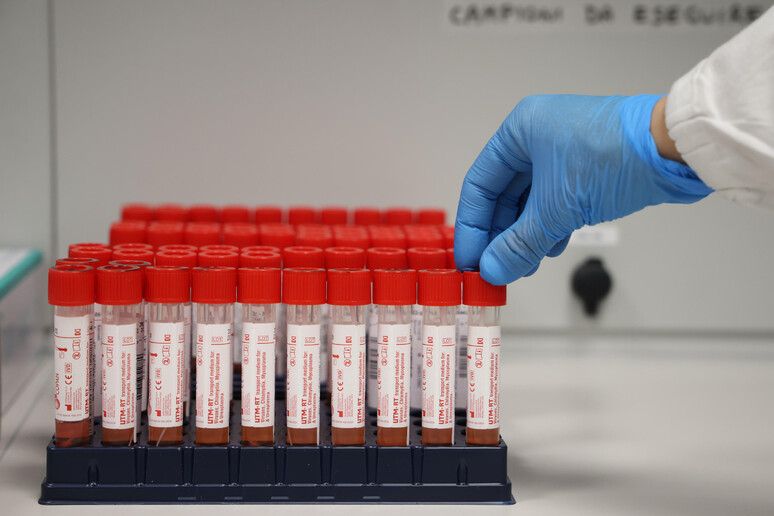 ++ Covid: tasso positivit� al 13%, +9 le intensive ++ - RIPRODUZIONE RISERVATA