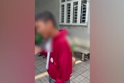 Perde uso del braccio, protesi 'firmata' a 14enne