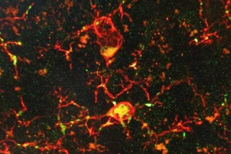 Cellule del sistema immunitario del cervello (fonte: Scuola Superiore Sant'Anna)