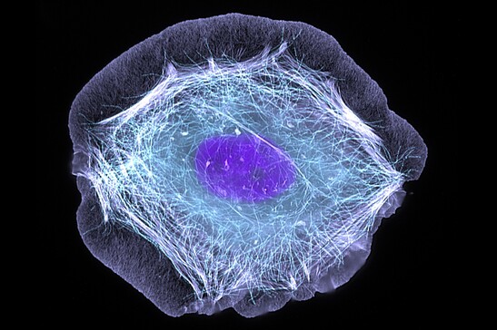Cellula della pelle (fonte: ZEISS Microscopy da Flickr, foto di Torsten Wittmann, University of California, San Francisco CC BY-NC-ND 2.0)