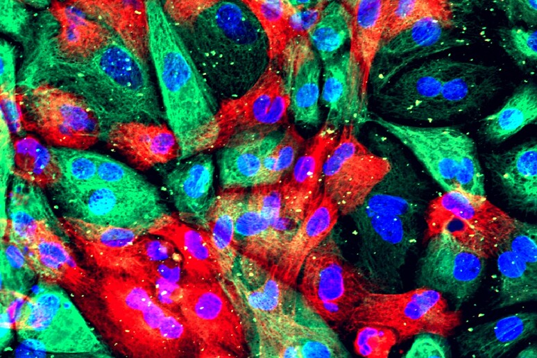 Cellule di un organoide di tumore della prostata (fonte: National Cancer Institute, National Institutes of Health da Flickr CC BY-NC 2.0) - RIPRODUZIONE RISERVATA
