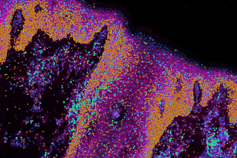 Ingrandimento di tessuto epiteliale (fonte:&nbsp;Wellcome Sanger Institute) - RIPRODUZIONE RISERVATA