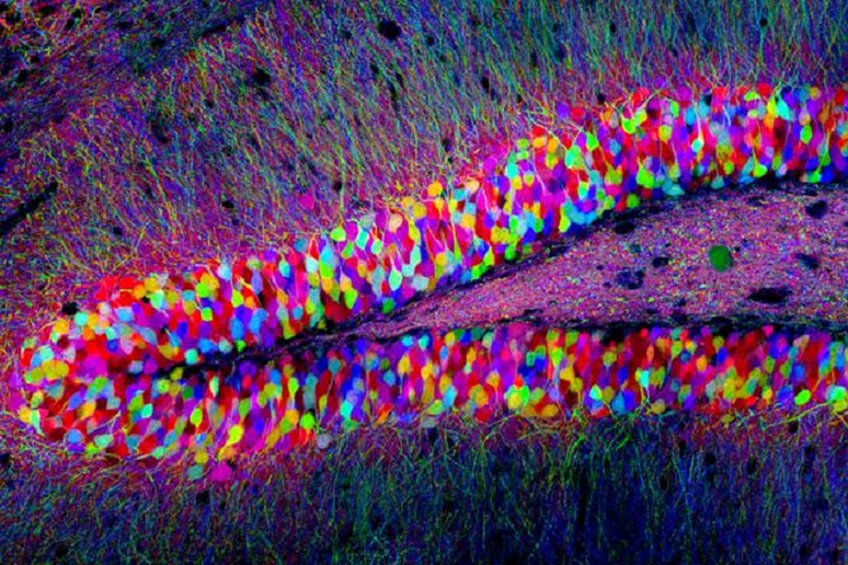 Cellule di ippocampo di topo (fonte: Tamily Weissman, Harvard University) - RIPRODUZIONE RISERVATA