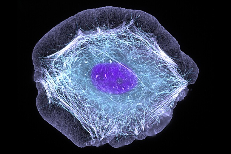 Cellula della pelle (fonte: ZEISS Microscopy da Flickr, foto di Torsten Wittmann, University of California, San Francisco CC BY-NC-ND 2.0) - RIPRODUZIONE RISERVATA