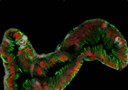 Per la prima volta e' stato costruito in laboratorio un intestino umano utilizzando le cellule staminali
